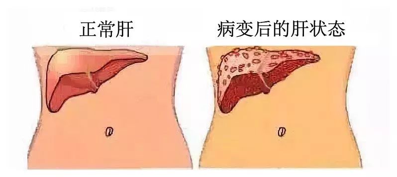 凤凰网梧桐汇商城|每天一杯养肝茶，皮肤润了，晚上睡得香