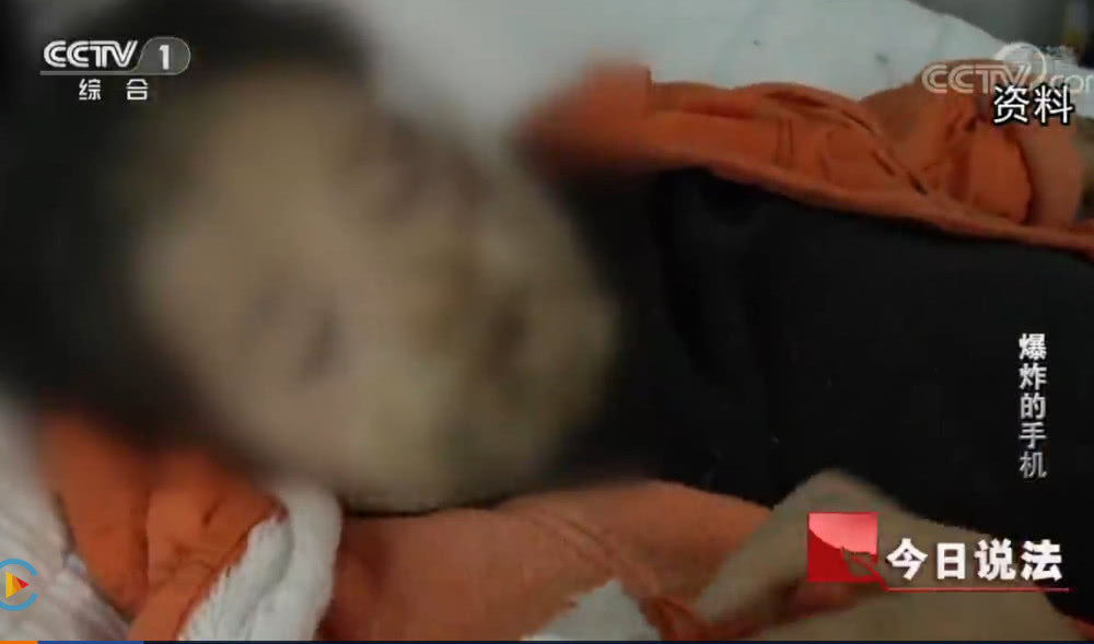 《今日说法》点名三星手机爆炸：4岁女孩脸被烧伤，至今未获赔偿