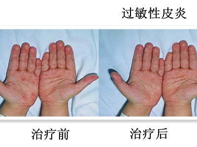 湖南花垣县 147 名小 学生尿汞超标  1名嫌犯被控