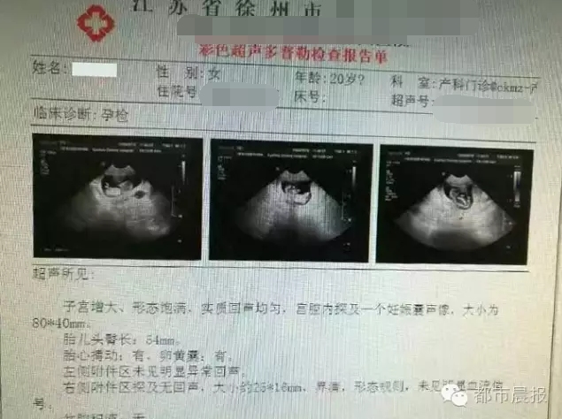 江苏：一名12岁女孩在医院做产检 疑似被拐卖手机凤凰网 0843