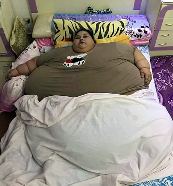 埃及女子重1200斤 将赴印度进行手术减肥
