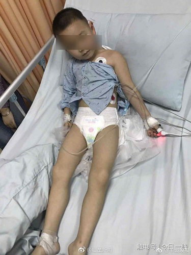 东莞一幼儿园保育员投放有毒药物 多名儿童中毒入院