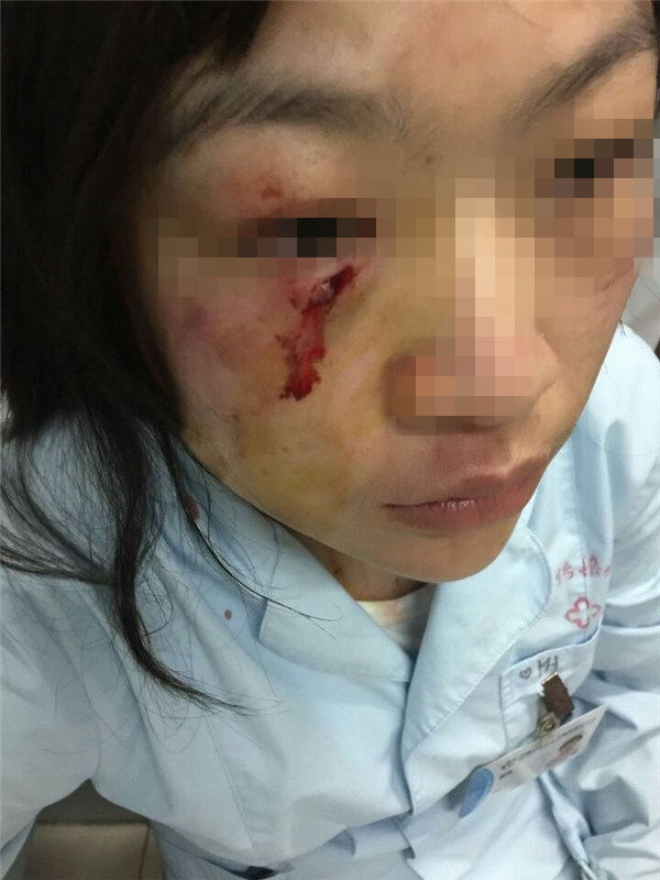 输液滴壶里有空气 患者家属殴打护士致其缝7针