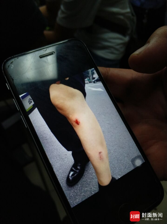 丈夫被查女子撕咬交警大腿 交警:已注射狂犬疫苗