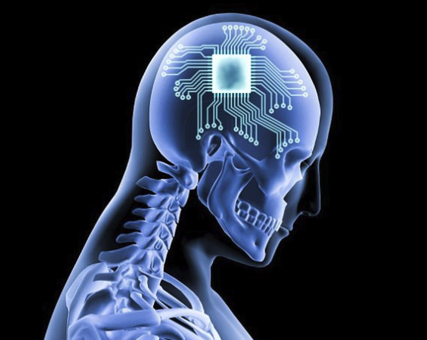 美军方在人身上测试AI芯片大脑植入技术 或可治疗抑郁