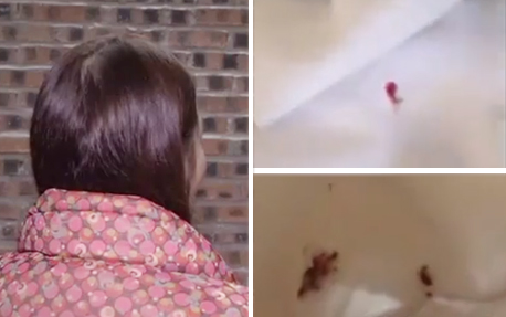女子入住广州酒店一晚， 醒来被血迹惊吓到