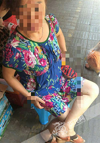 老太被水果店里的猫抓伤 店主不愿承担责任引