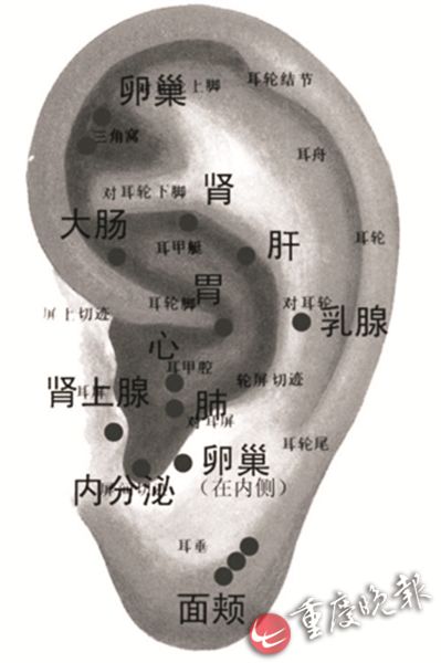 霍氏小药丸巧治耳鸣 耳聋