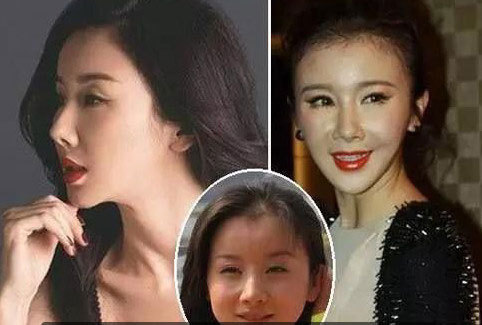 心疼!这些女明星整容失败变“丑女”