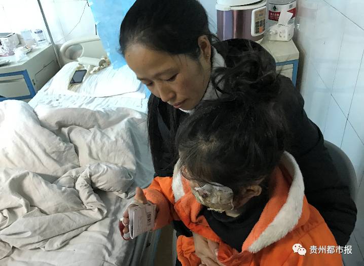 三星手机又爆炸 贵州一5岁女童双手及脸部被烧伤
