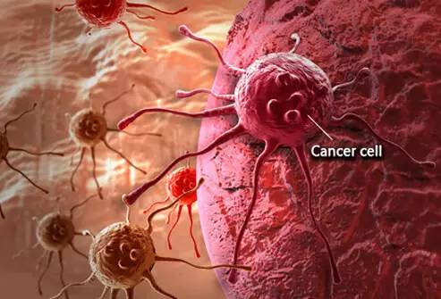 《科学》杂志重磅发现：66%癌症发生是因运气不好