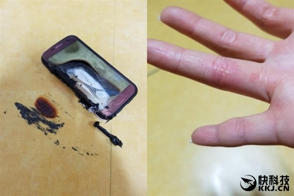 三星Galaxy S7突然自燃：20岁姑娘被烧伤