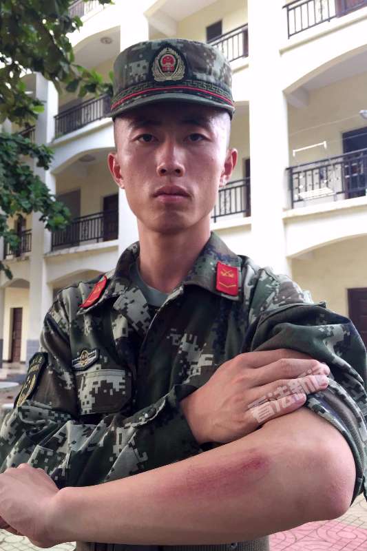 徒手接住老人时，戴子乾手臂擦伤。