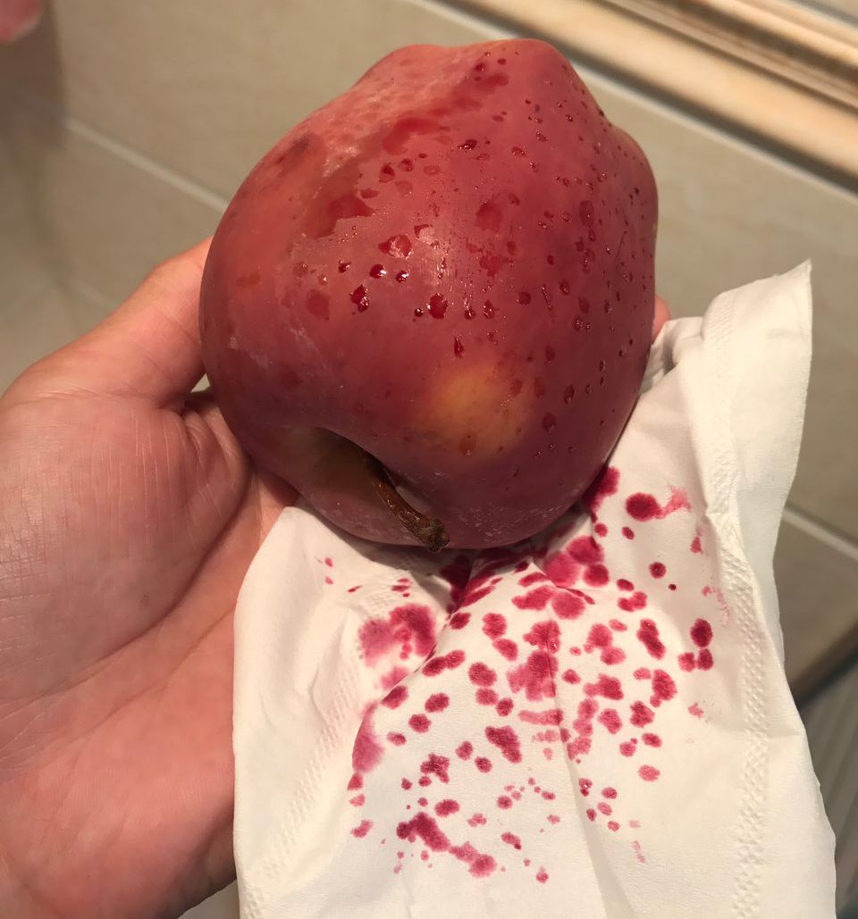 吓得我一愣一愣的！擦干净过后，又会冒出来红的&hellip;&hellip;