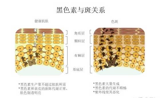 98bdf753ab1d653_w580_h344.png