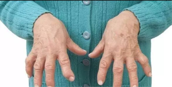 手指抽筋是怎么回事,钙尔奇d有效补钙不用愁_