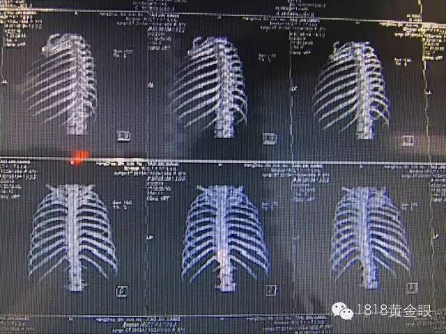 二十多岁小伙儿给大妈按摩，按摩时……啪！(图)