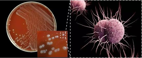 淋病奈瑟菌的分离培养照片及其模式图（图片来源：中国科学院微生物研究所）