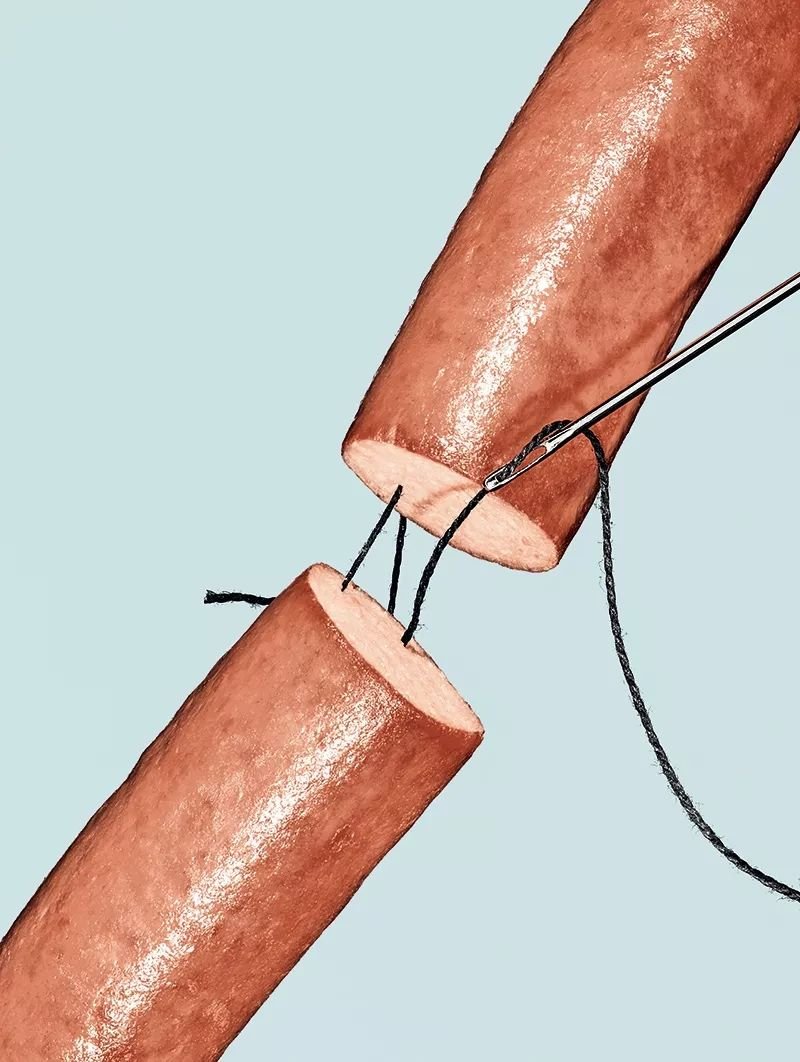 65岁的身体，20岁的下体，他做阴茎移植术成美国最幸运的男子_凤凰网, image size:800x1062