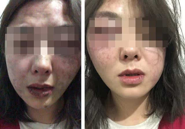 女子四川西昌旅游在烧烤店遭男子殴打 打人者已被刑拘