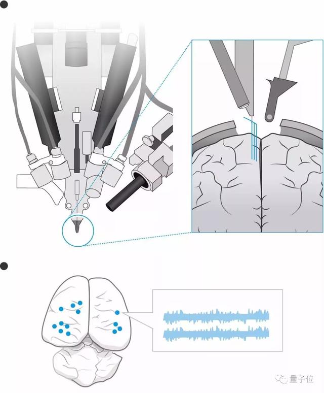 馬斯克發布腦機接口系統！晶片直連大腦，可用iPhone操控 科技 第8張