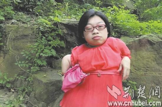 89厘米袖珍"瓷娃娃"怀孕后勇敢当妈妈(图)