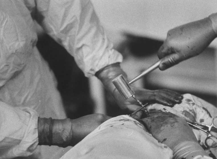 前苏联狗头移植实验