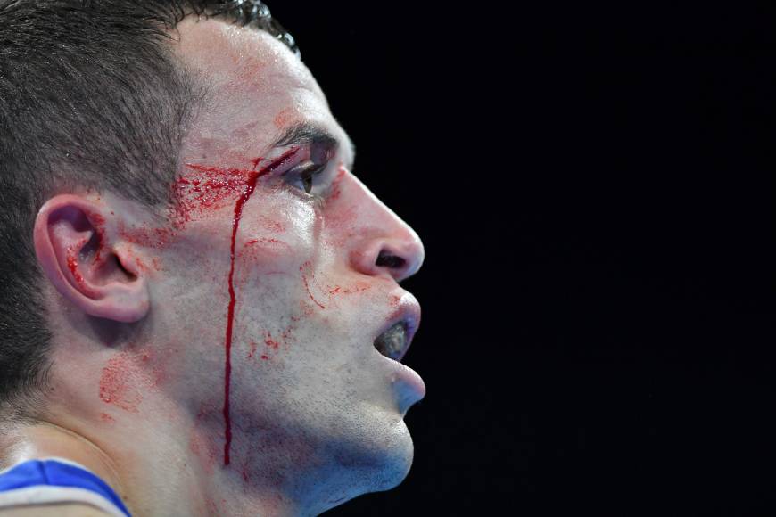 拳击比赛受伤图片