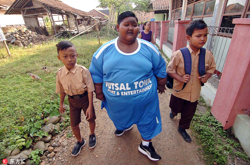 世界最胖男孩减10斤后恢复行走