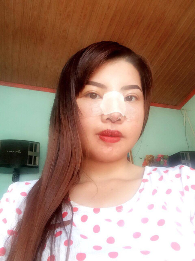 爆唇女相亲遭呛 整形后秒嫁富二代