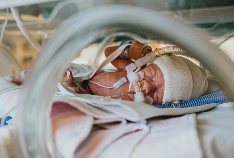 澳大利亚母亲记录早产儿子艰难求生过程