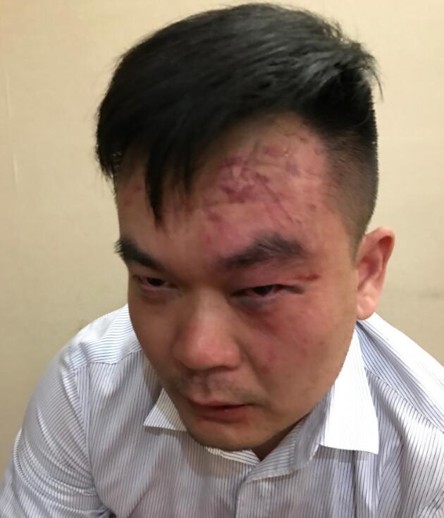 nbl爆发大规模群殴 多人飙血伤势严重