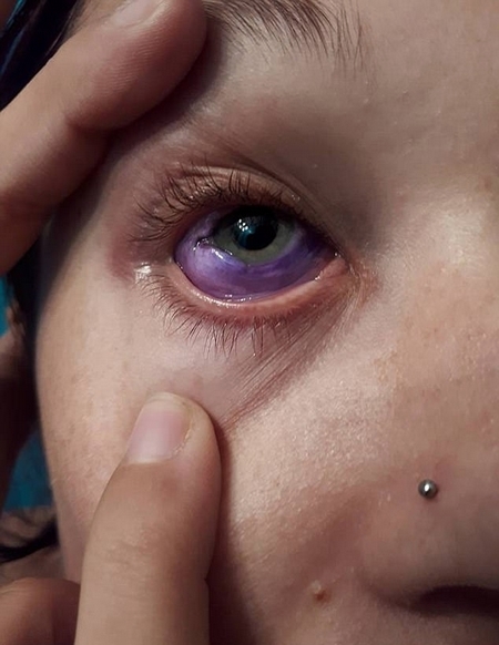 慎点此新闻女模特给眼球纹身致永久性损伤