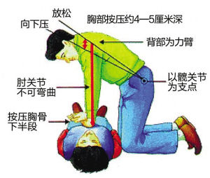 女性被心肺复苏抢救成功率远低于男性因为有胸