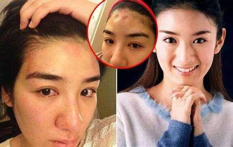 女星也遭家暴 伤痕触目惊心