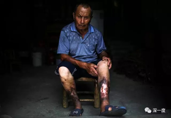 图片故事日军细菌战的24位中国受害者及遗属