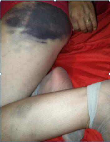 女子惨遭家暴20年浑身是伤还得给情妇做饭